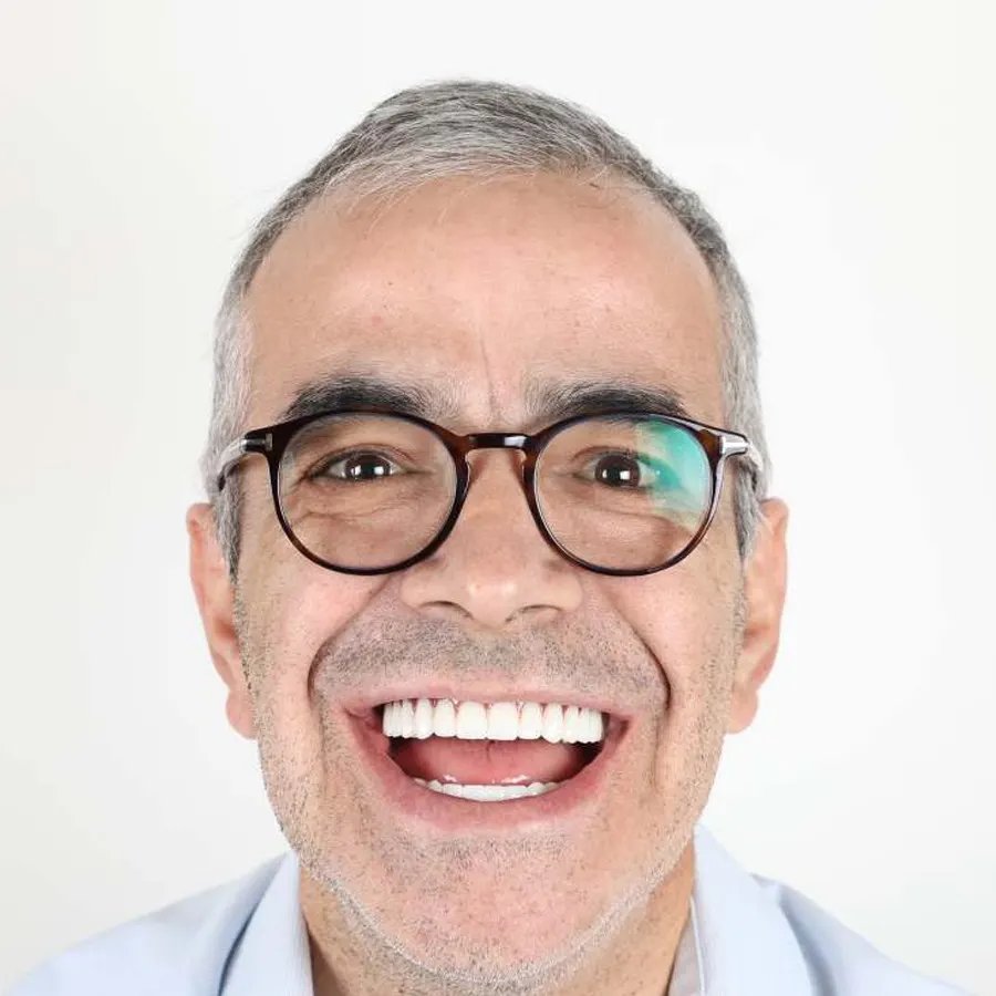 Smile makeover — After