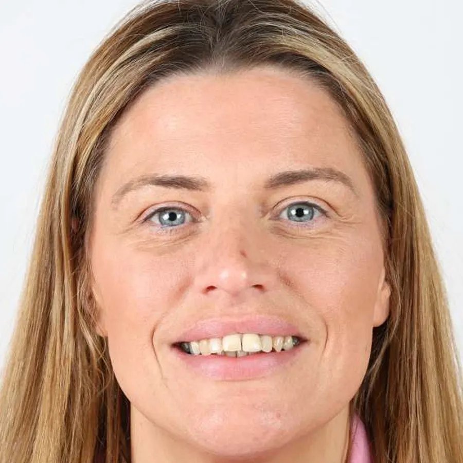 Smile makeover — Before