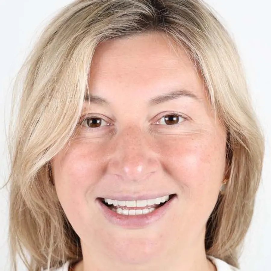 Smile makeover — After