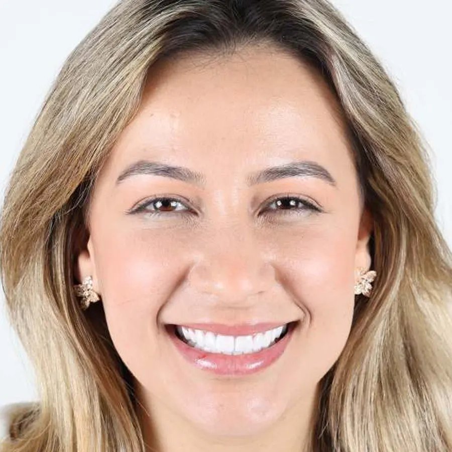 Smile makeover — After
