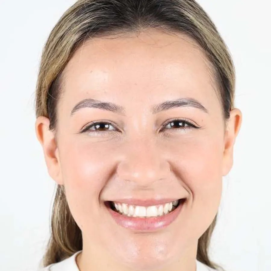 Smile makeover — Before