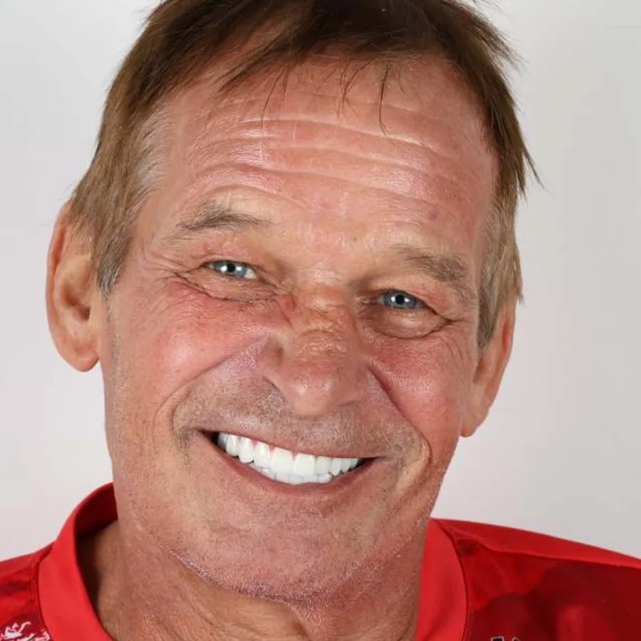 Smile makeover — After