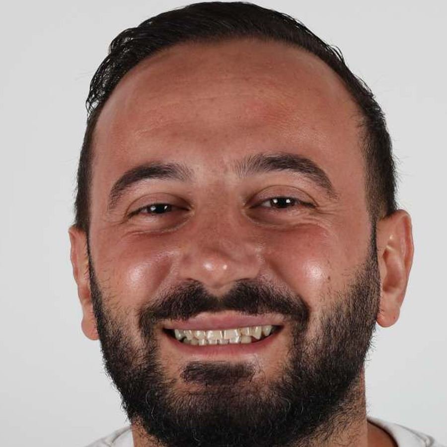 Smile makeover — Før