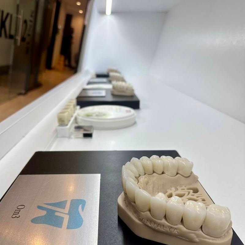 An E.max full-arch shade sample on its plinth in the Tantalya showroom