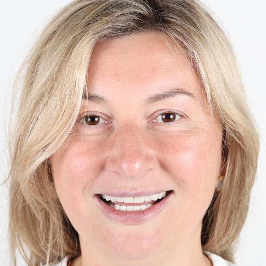 Smile makeover — Efter